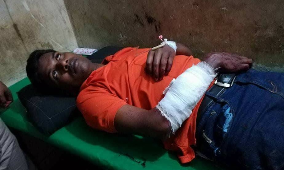 আসামি ধরতে গিয়ে হামলায় আহত পুলিশ কর্মকর্তা