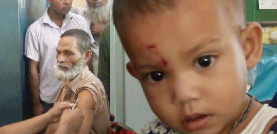 পাগলা কুকুরের কামড়ে শিশুসহ শতাধিক আহত