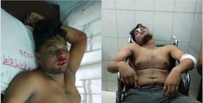 কোটা সংস্কার আন্দোলনে থাকায় জবি শিক্ষার্থীকে পিটিয়ে রক্তাক্ত