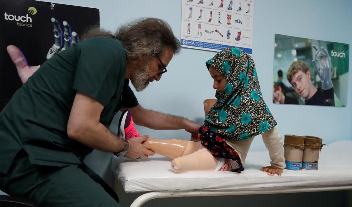 তুরস্কে কৃত্রিম পা পেল সিরীয় প্রতিবন্ধী শিশু