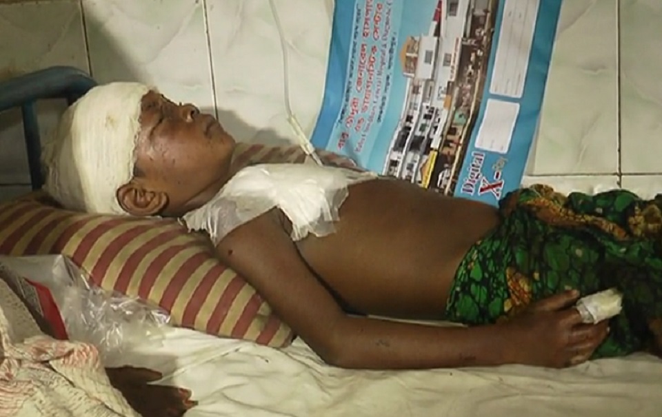 ককটেলকে ক্রিকেট বল ভেবে খেলতে গিয়ে বিস্ফোরণে শিশু আহত