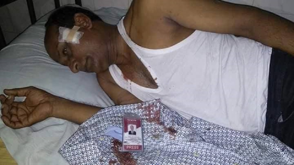 নাটোরে দৈনিক যুগান্তরের উপজেলা প্রতিনিধির ওপর দুর্বৃত্তদের হামলা