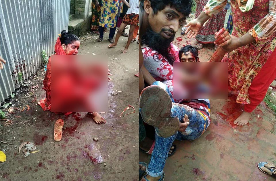 শ্রীপুরে স্ত্রীকে ছুরি মেরে স্বামীর আত্মহত্যা