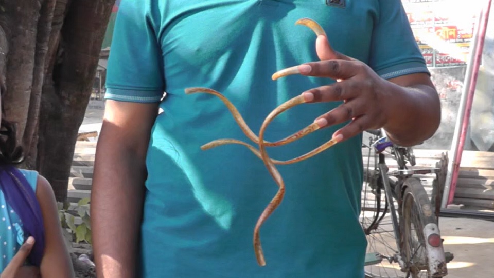 ২৫ বছর নখ কাটেনি ফুলাবাড়ীর অরুন