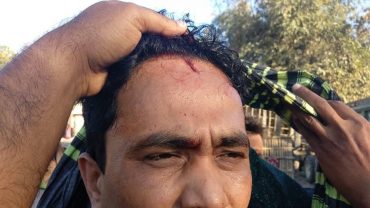 কোম্পানিগঞ্জে টাস্কফোর্সের ওপর পাথর খেকোদের হামলা