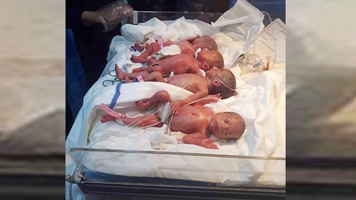 অস্ত্রোপচার ছাড়াই একসঙ্গে ৭ সন্তান জন্ম!