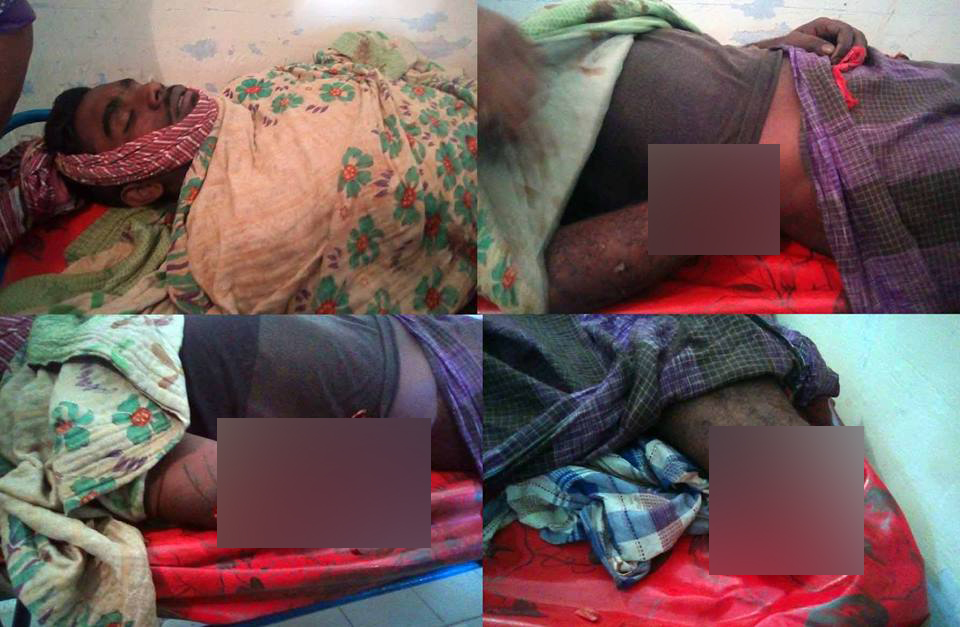হত্যা মামলার আসামির হাত-পা কেটে হত্যা