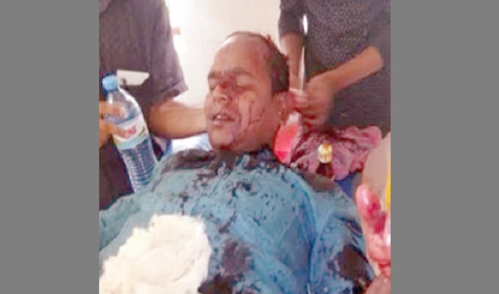 প্রধান শিক্ষককে দা দিয়ে কোপালেন সহকারী শিক্ষক