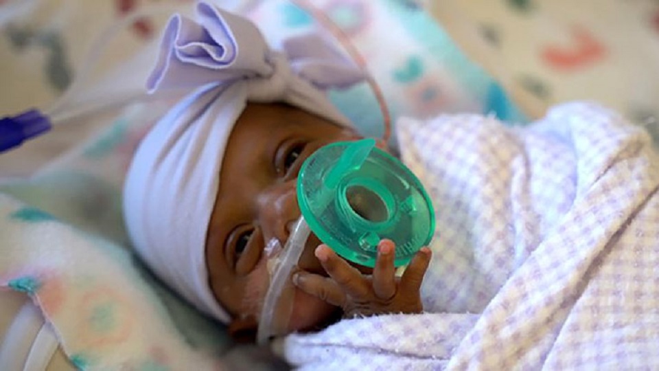 বিশ্বের সবচেয়ে কম ওজনের নবজাতক সাইবি