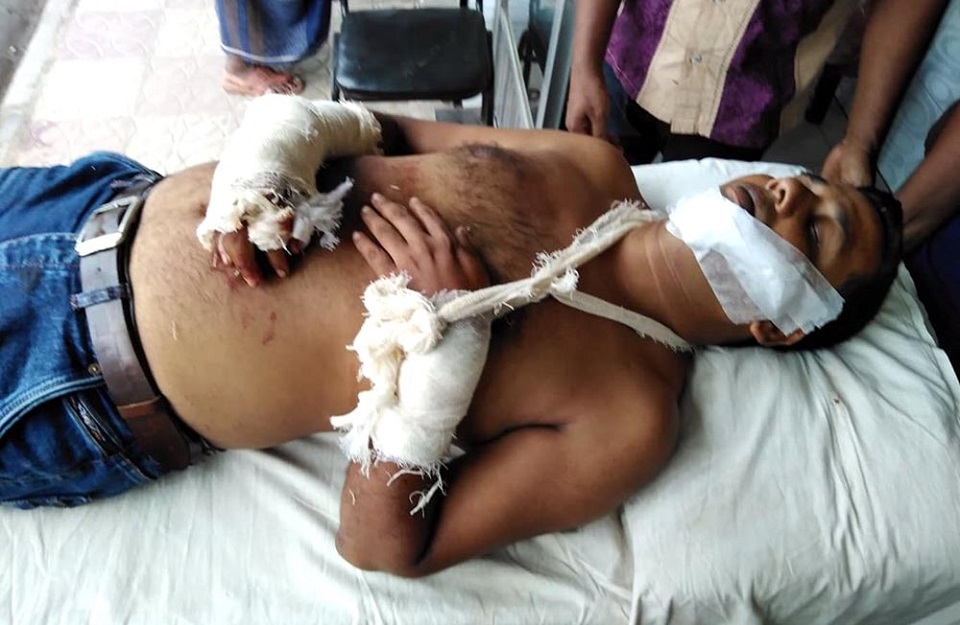 পিরোজপুরে আসামির দায়ের কোপে পুলিশ জখম