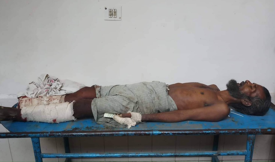 পটুয়াখালীতে চোর সন্দেহে গণপিটুনিতে ১ জন নিহত