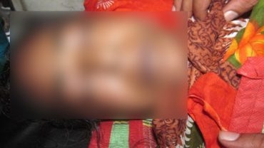 যশোরে ডেঙ্গুতে আক্রান্ত নারীর মৃত্যু