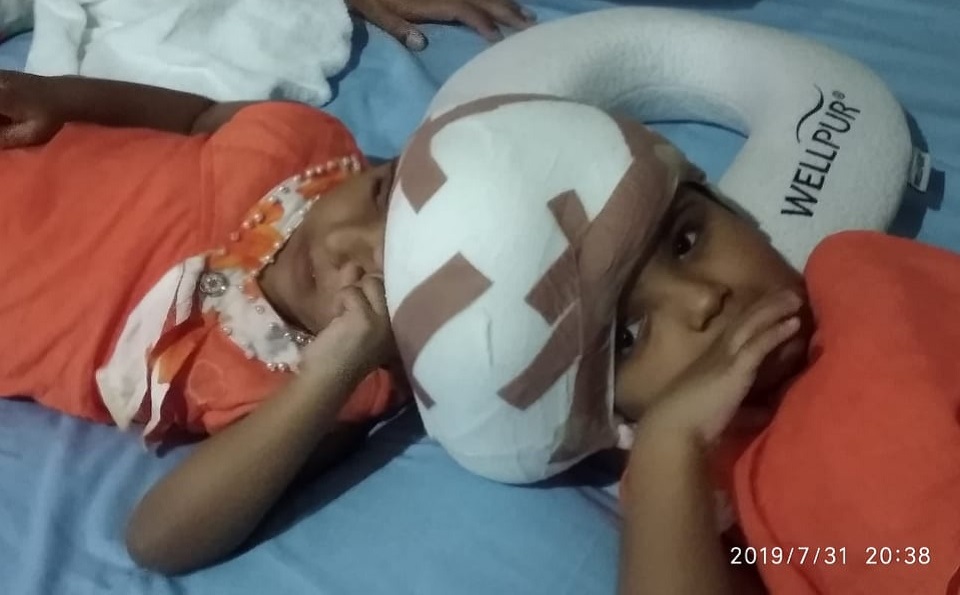 সিএমএইচ-এ রাবেয়া-রোকেয়ার জমজ মাথার সফল অস্ত্রোপচার