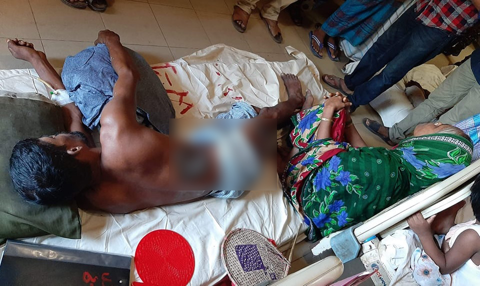 স্ত্রীকে ধর্ষণের বিচার চেয়ে মানববন্ধন করায় স্বামীকে এসিড নিক্ষেপ