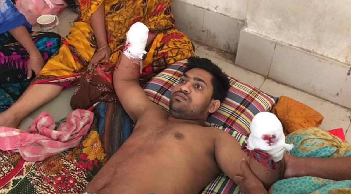 ২ হাতের কব্জি কেটে নেয়ার অপরাধ কী!