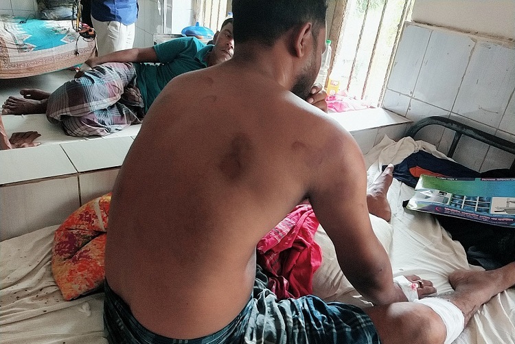 মেয়ের কথিত প্রেমিককে হাতুড়িপেটা করলেন বাবা