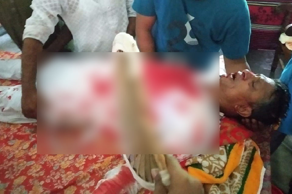 নাগরপুরে আ’লীগ নেতাসহ ৫ জনকে কুপিয়ে জখম