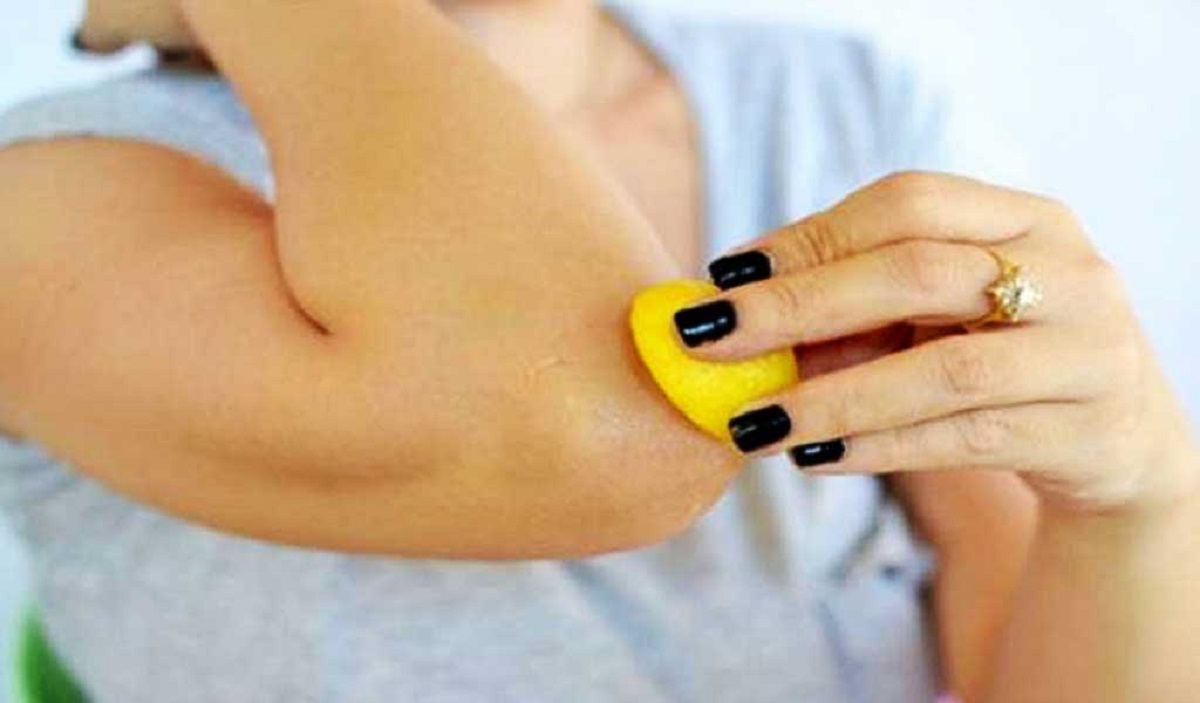 কনুইয়ের কালো দাগ দূর করার ঘরোয়া ৩ উপায়