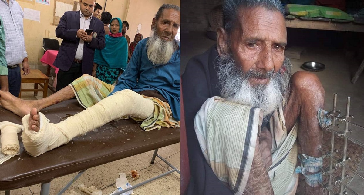 ফেসবুকে স্ট্যাটাস, পা থেকে রড বের করা হলো সেই বৃদ্ধের