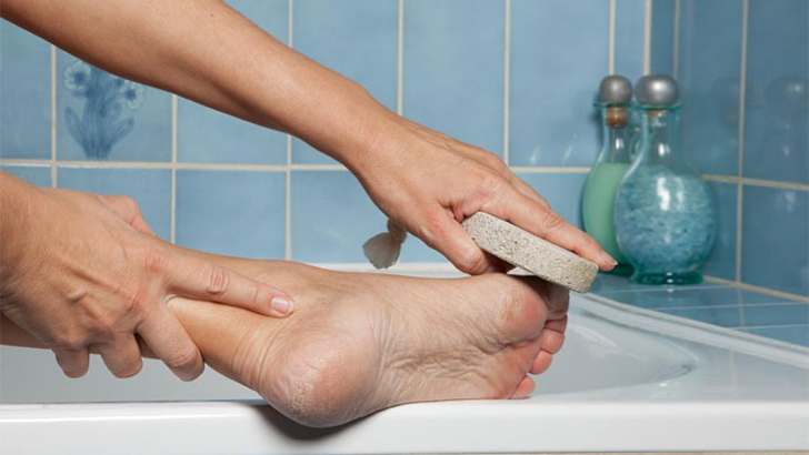 শীতে পায়ের গোড়ালি ফাটা দূর করার ঘরোয়া উপায়