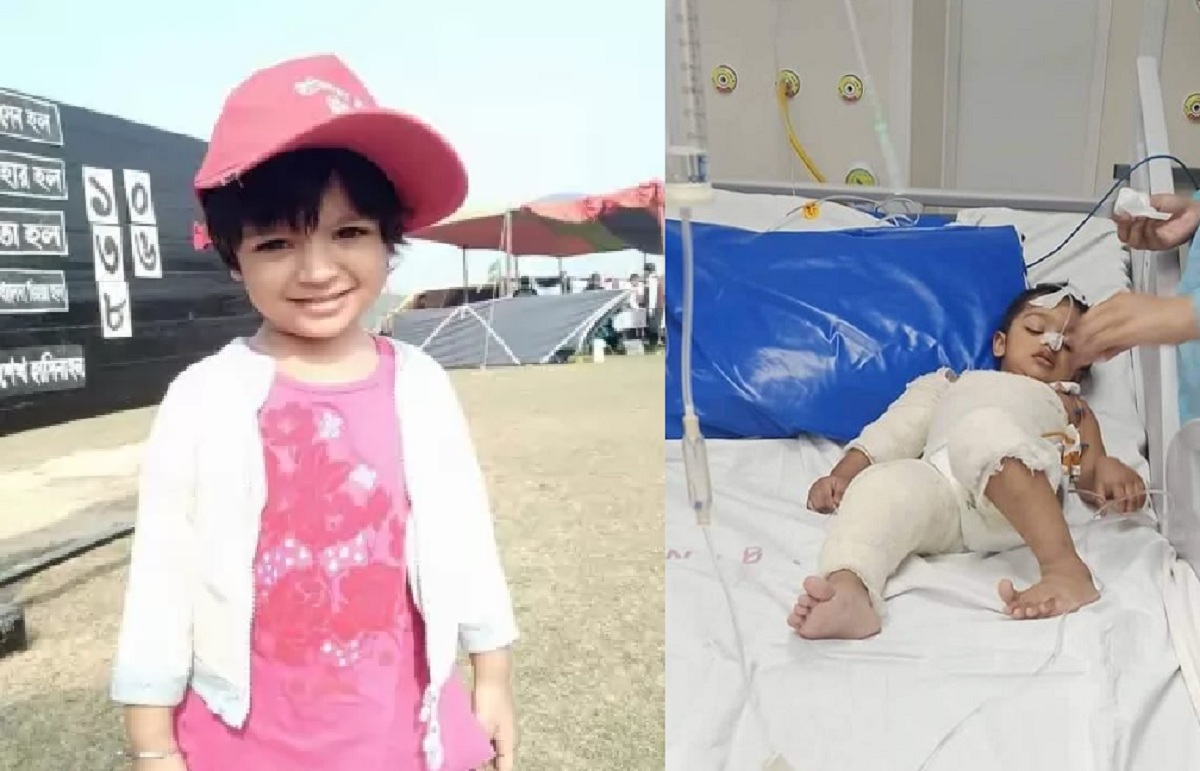 গোসলের গরম পানিই কাল হলো; আইসিইউতে শিশু সরৌশী