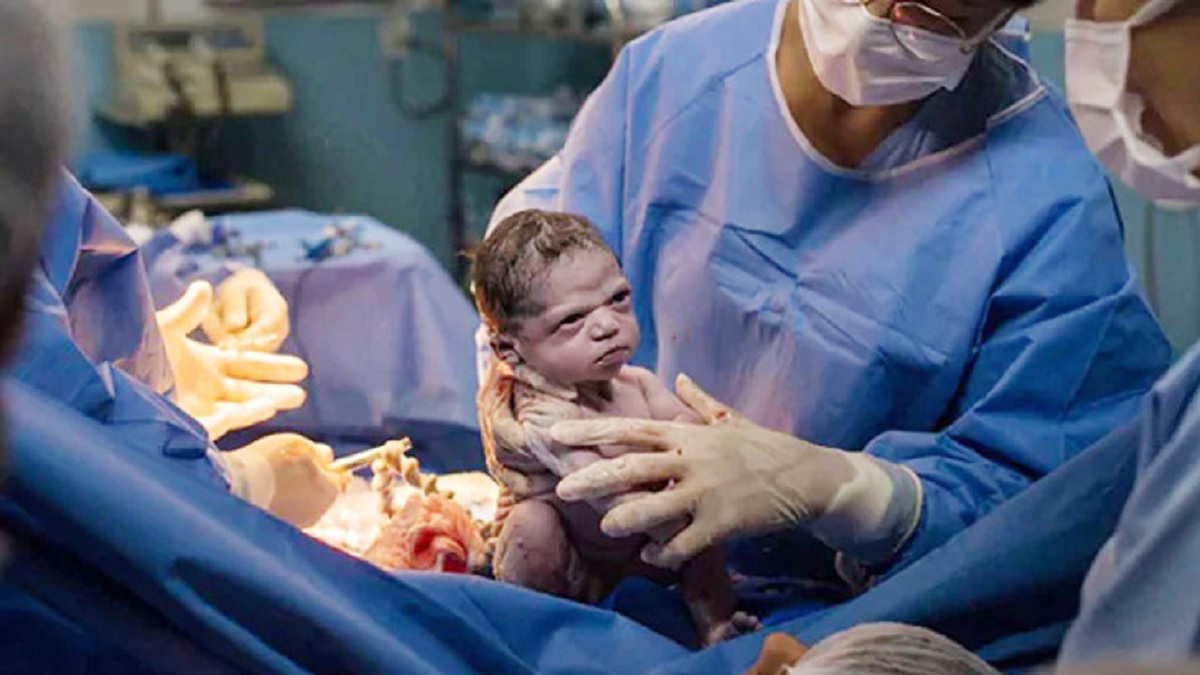 জন্মের পরই রেগে আগুন নবজাতক, ছবি ভাইরাল