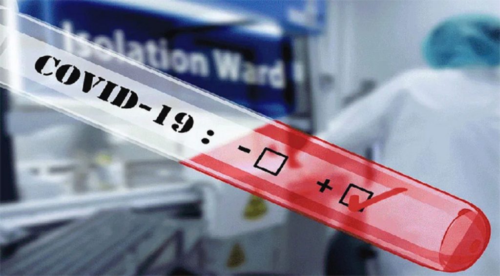 বিআইটিআইডির ল্যাবপ্রধানের করোনা শনাক্ত