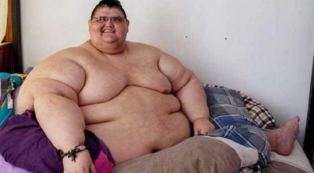 ২০৮ কেজি ওজন আর অনেক অসুখ নিয়েও করোনা জয়