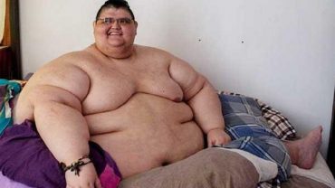 ২০৮ কেজি ওজন আর অনেক অসুখ নিয়েও করোনা জয়