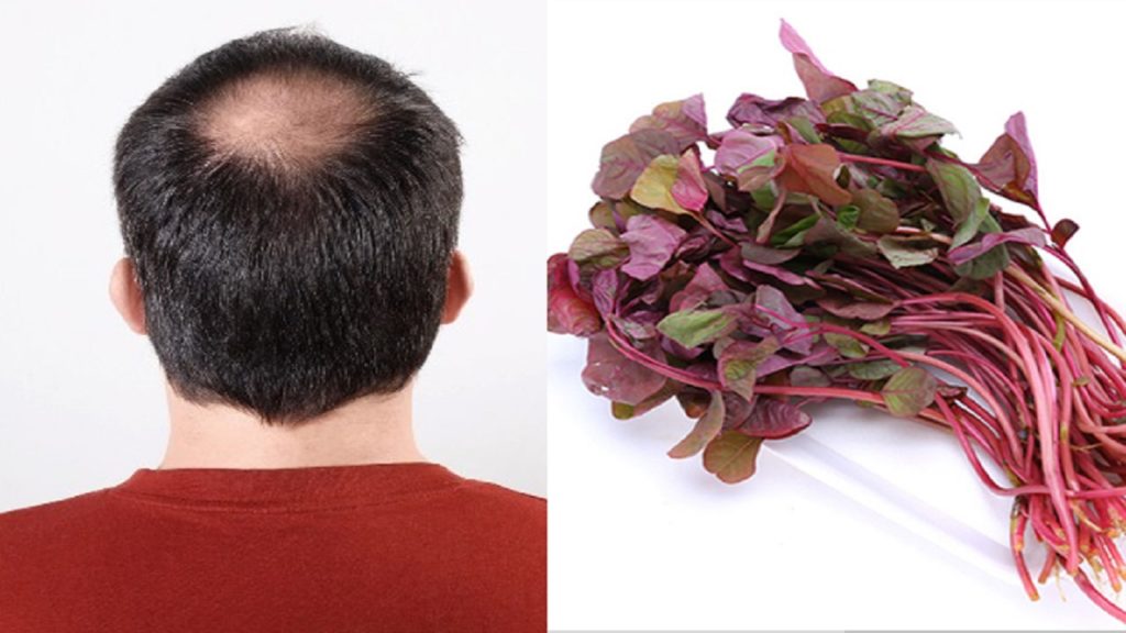 টাক পড়া রুখতে পারে লালশাক!