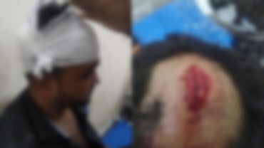 কলাপাড়ায় ছাত্রলীগের হামলায় বিএনপির উঠান বৈঠক পণ্ডের অভিযোগ; আহত ১০
