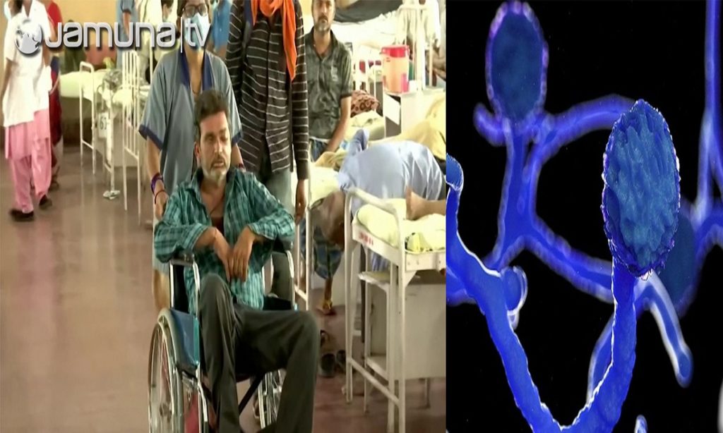 ভারতে করোনার মধ্যেই বাড়ছে ব্ল্যাক ফাঙ্গাস আতঙ্ক