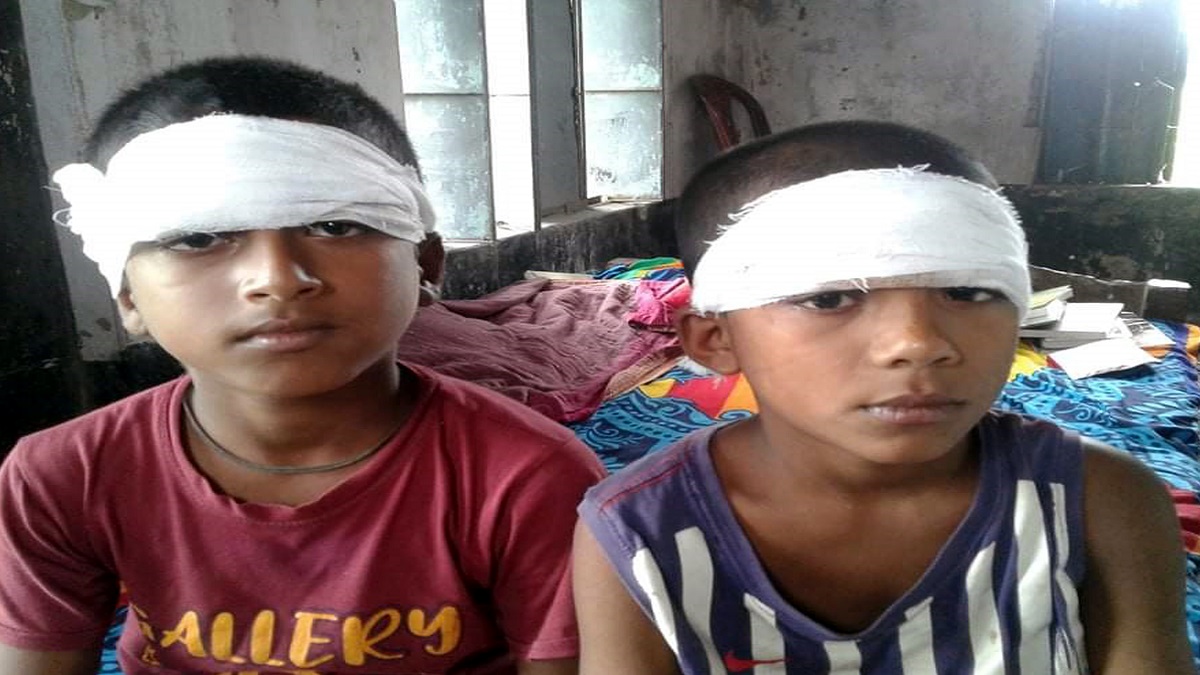 তালিমের সময় ঘুম; ২ ছাত্রের মাথা ফাটালেন মাদ্রাসা শিক্ষক