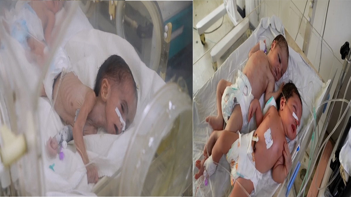 স্বাস্থ্যঝুঁকিতে আফগান শিশুরা, মিলছে না যথাযথ সেবা