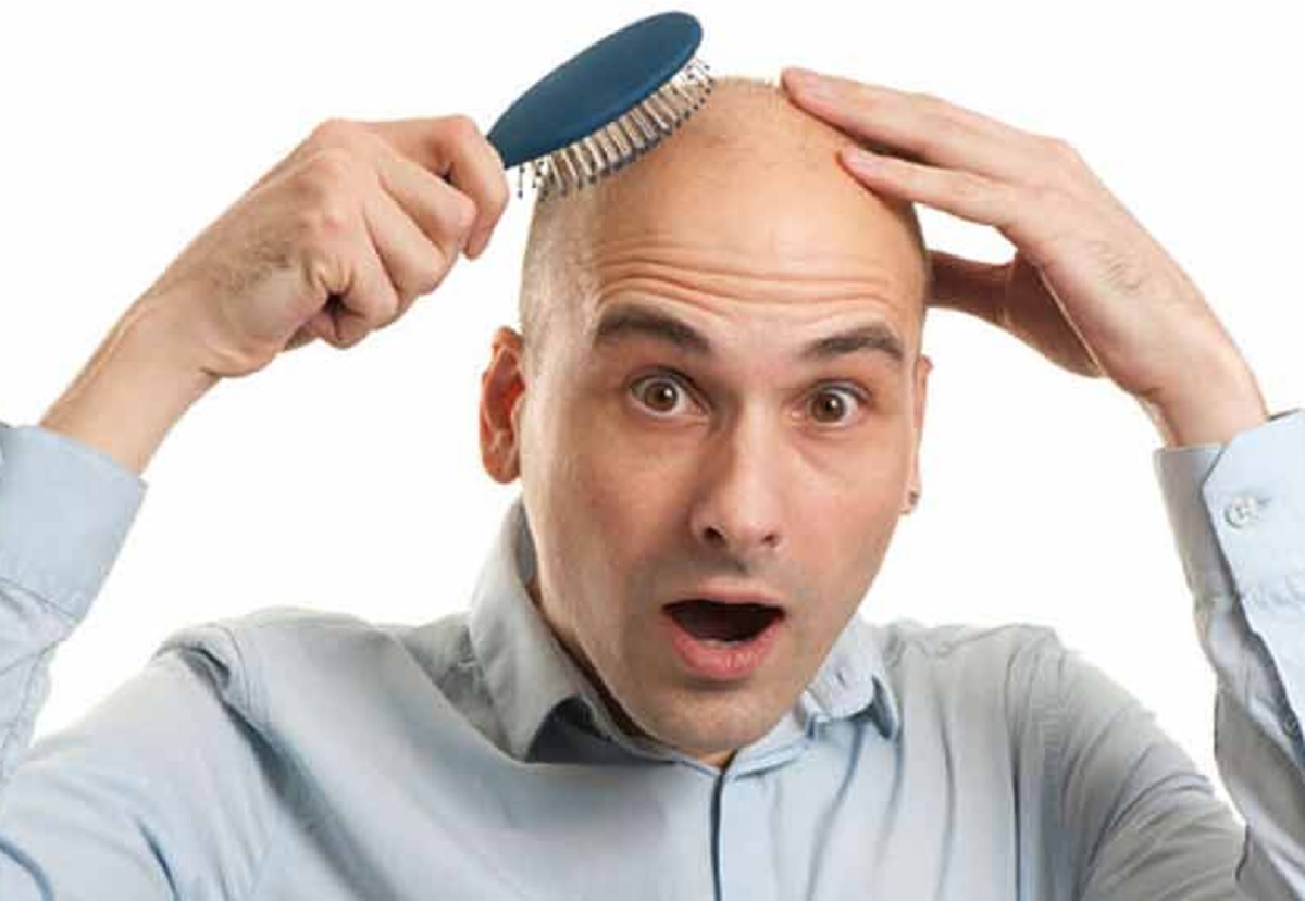 কম বয়সেই টাক? প্রসাধনী ছাড়াই আছে চমৎকার সমাধান