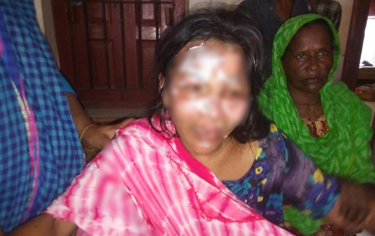 কবিরাজের চিকিৎসায় ঝলসে গেল রোগীর মুখ