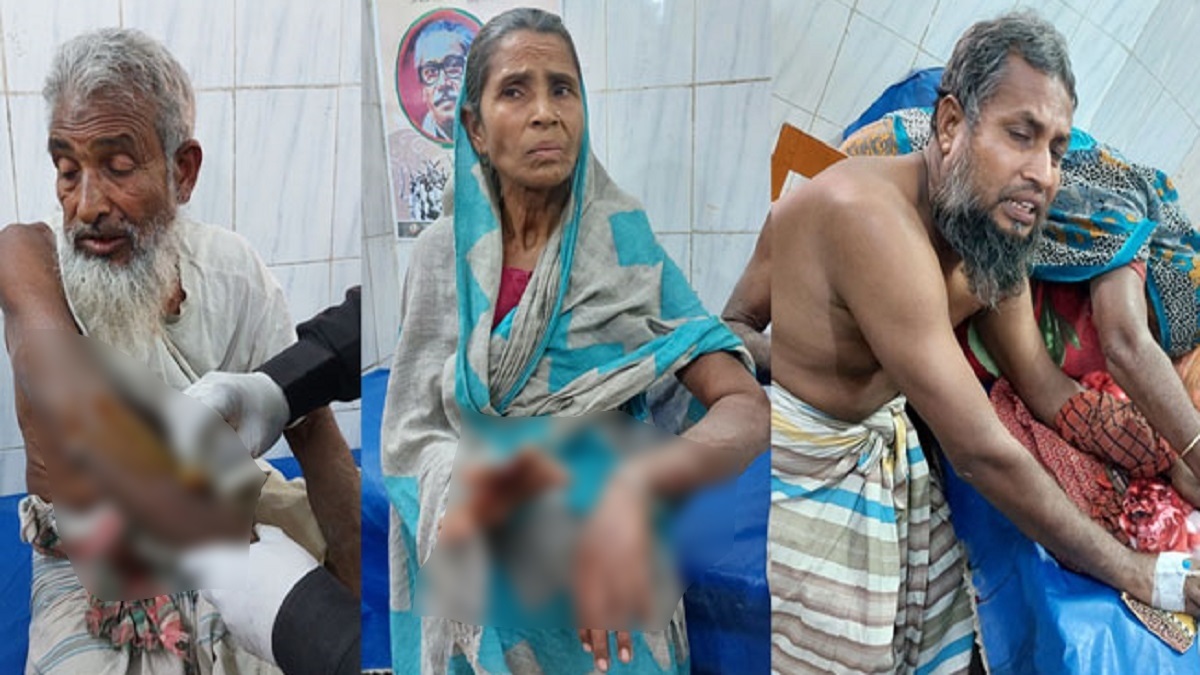 পাবনায় জমি নিয়ে বিরোধের জেরে হামলা, নারীসহ আহত ৪