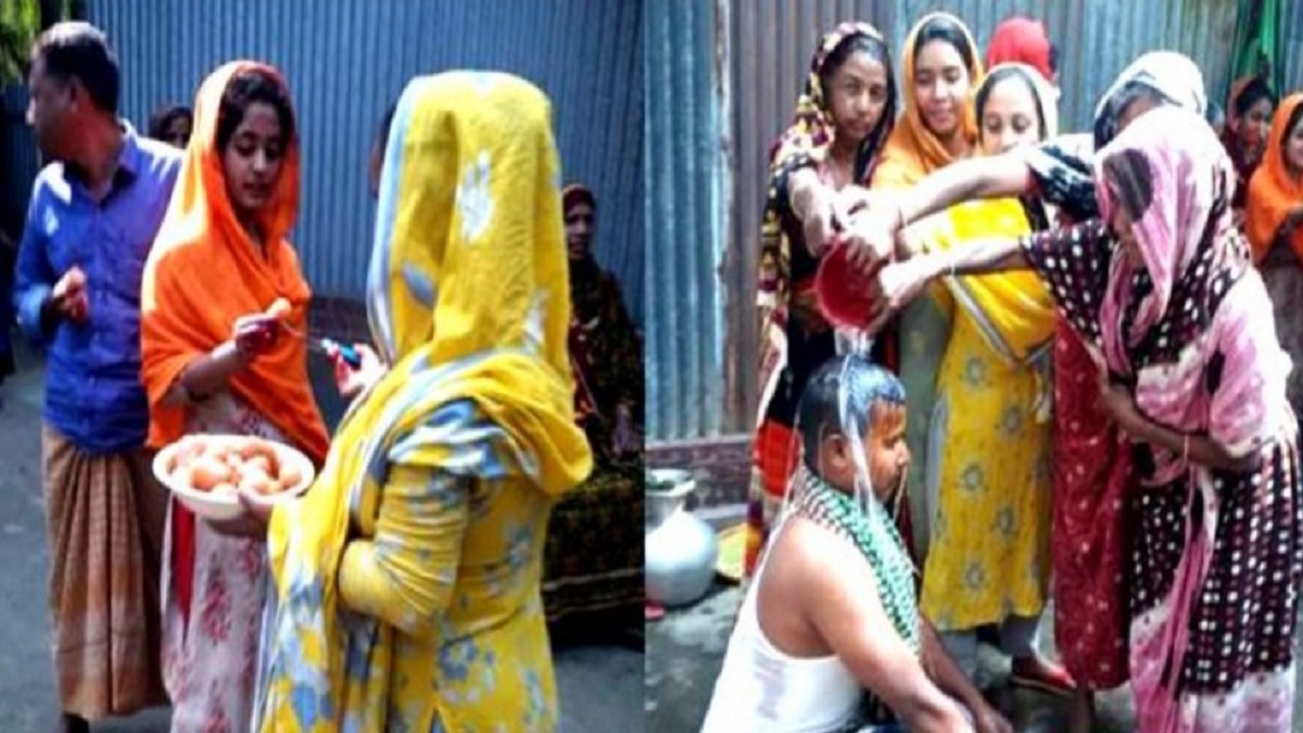 ৩৪ বছর বয়সে সুন্নতে খতনা!