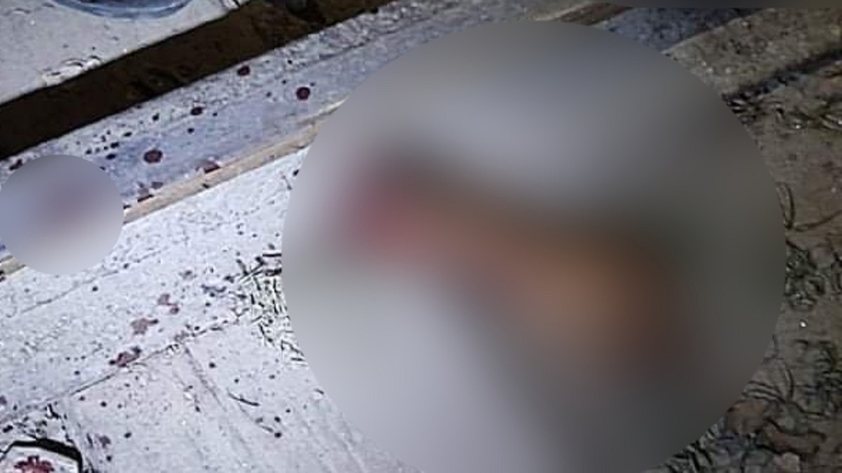 নারী সংক্রান্ত দ্বন্দ্বের জেরে যুবকের কবজি বিচ্ছিন্ন