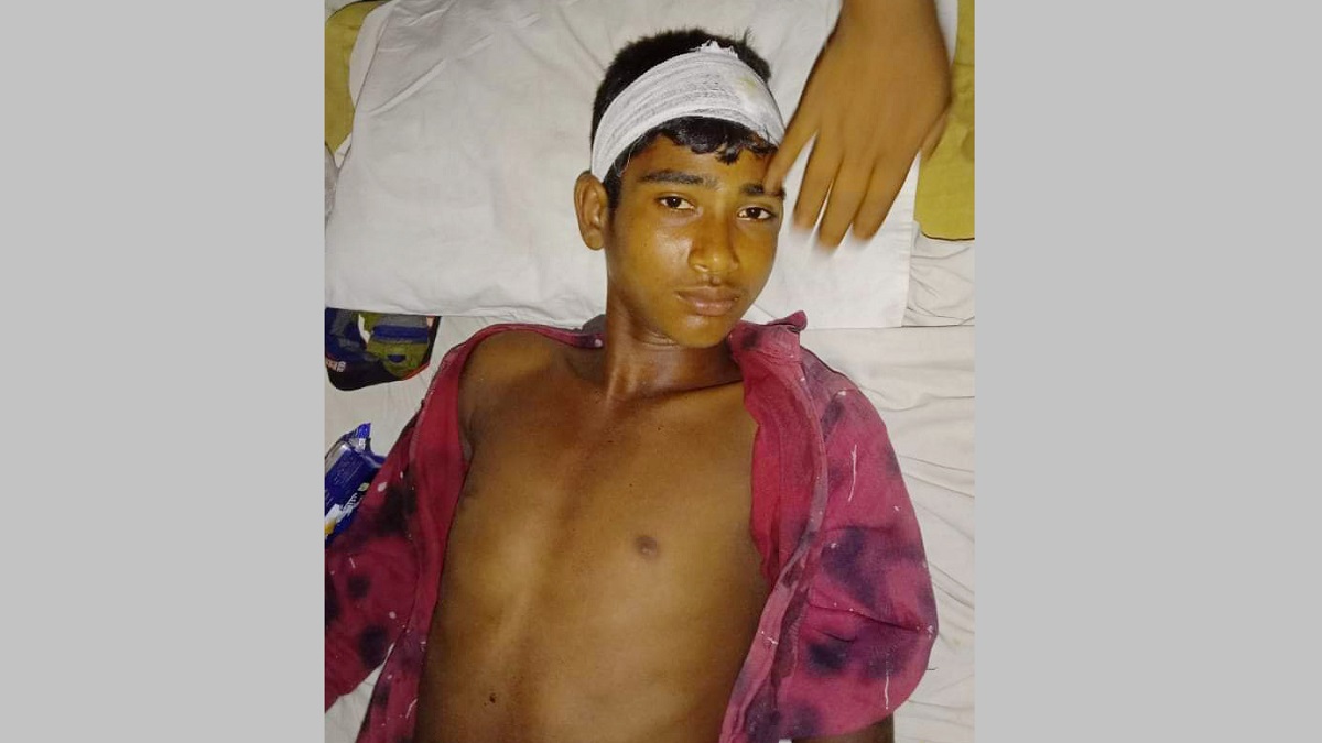 মাকে দেয়া কু-প্রস্তাবের প্রতিবাদ করায় কিশোর ছেলেকে পিটিয়ে আহত