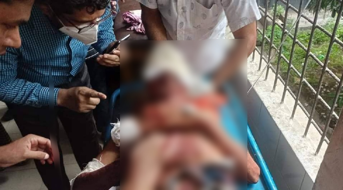 রাজবাড়ীতে দুর্বৃত্তদের হামলার শিকার একের পর এক ছিন্নমূল বৃদ্ধ, রহস্য ঘনীভূত