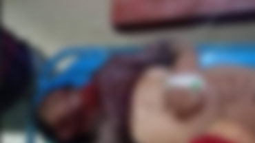 রাজবাড়ীতে বাস চাপায় মোটরসাইকেল আরোহী নিহত