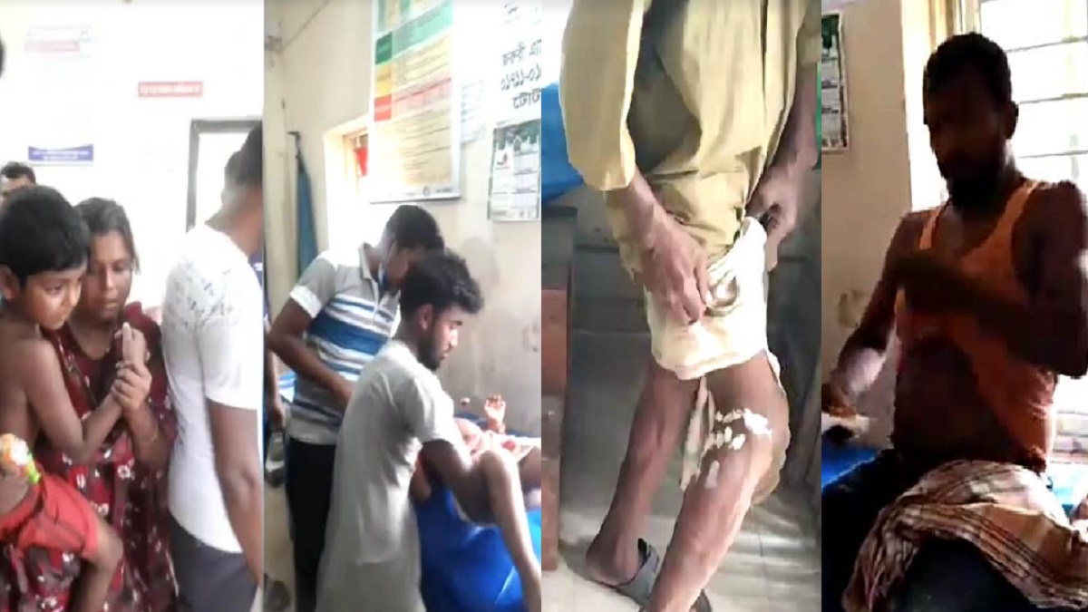 শৈলকুপায় কুকুরের কামড়ে আহত অন্তত ১৪