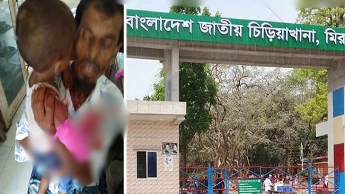 মিরপুর চিড়িয়াখানায় হায়েনার আক্রমণে শিশুর হাত বিচ্ছিন্ন