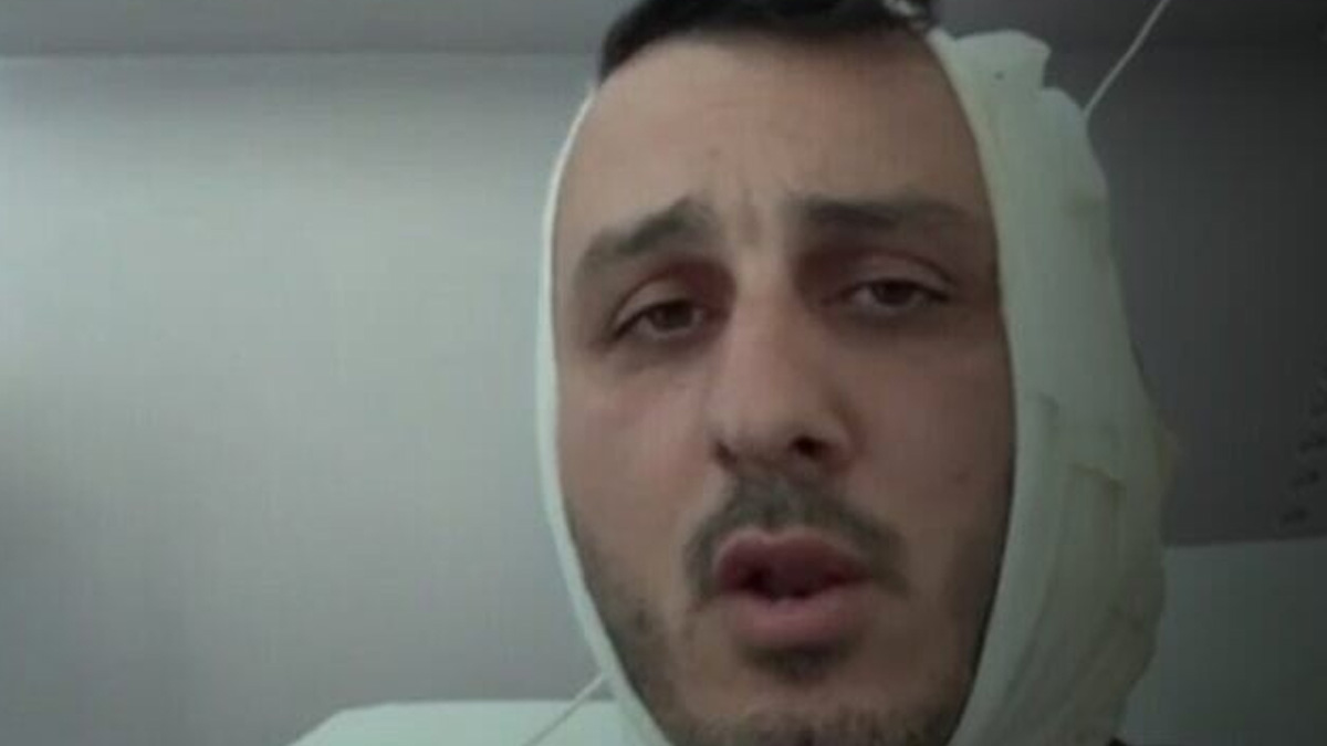 ইসরায়েলি পর্যটকের কান ছিঁড়ে ফেললেন এক সিরীয়